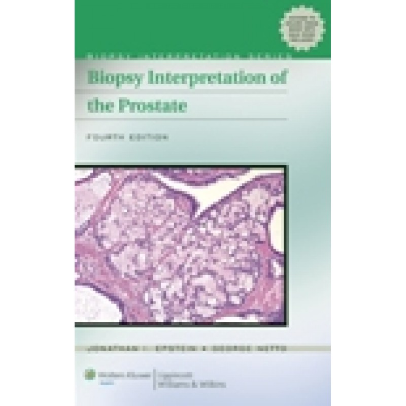 Biopsy Interpretation of the Prostate 4/e