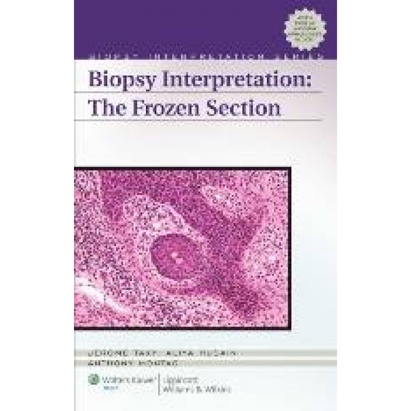 Biopsy Interpretation of the Frozen Section