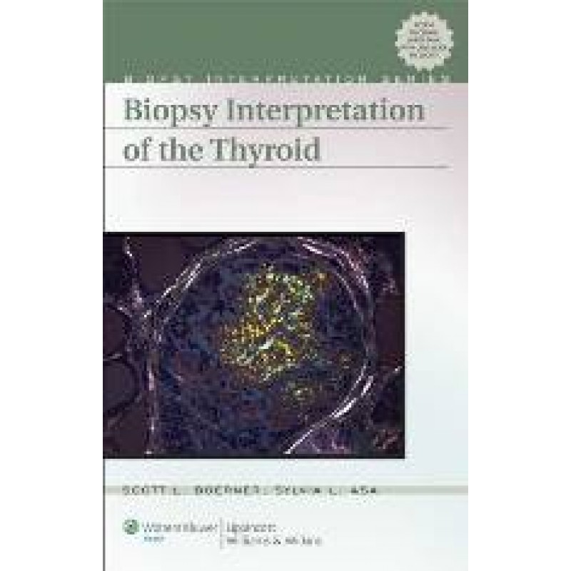 Biopsy Interpretation of Thyroid