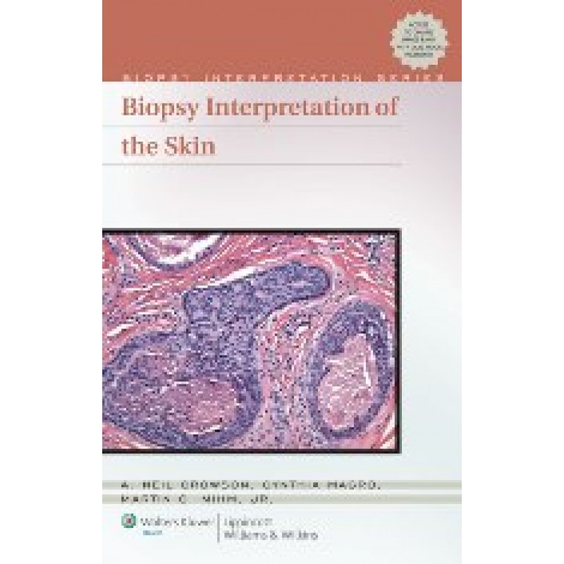 Biopsy Interpretation of the Skin