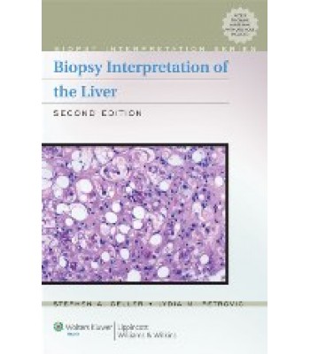 Biopsy Interpretation of the Liver 2/e