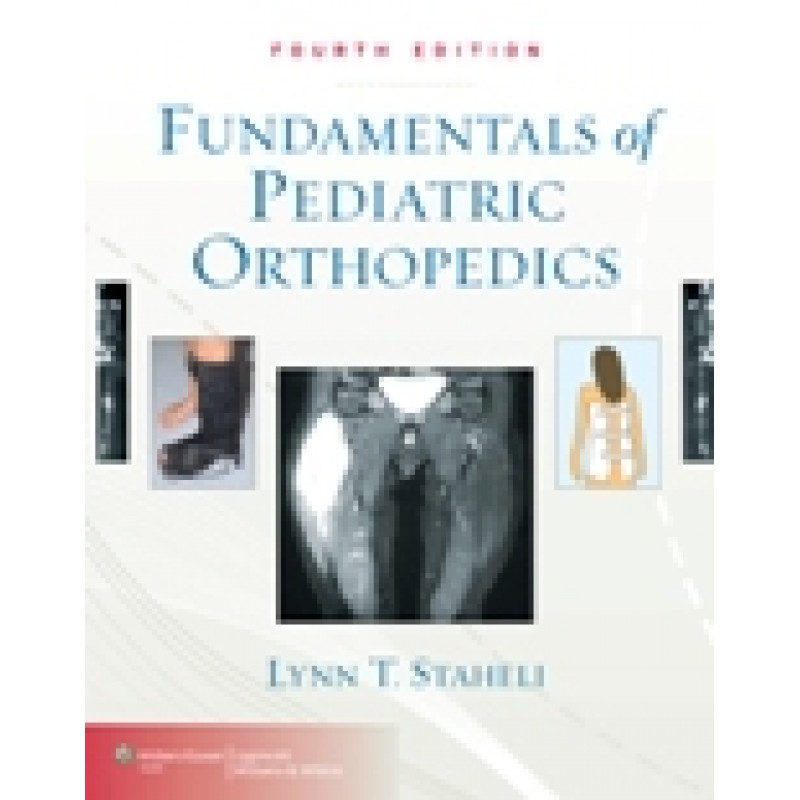 Fundamentals of Pediatric Orthopedics 4/e