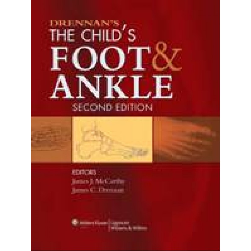 Drennan's The Child's Foot and Ankle 2/e