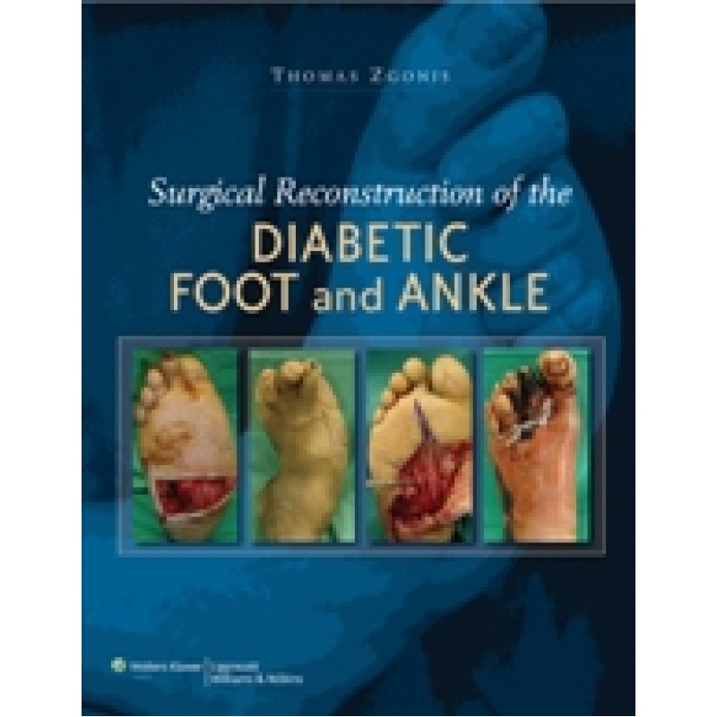 Surgical Reconstruction of the Diabetic Foot and Ankle