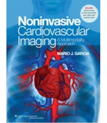 Cardiovascular Imaging