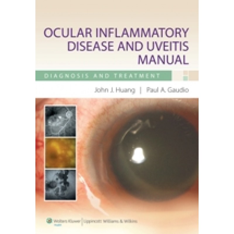 Ocular inflammatory Diseases and Uveitis Manual - Diagnosis and Treatment