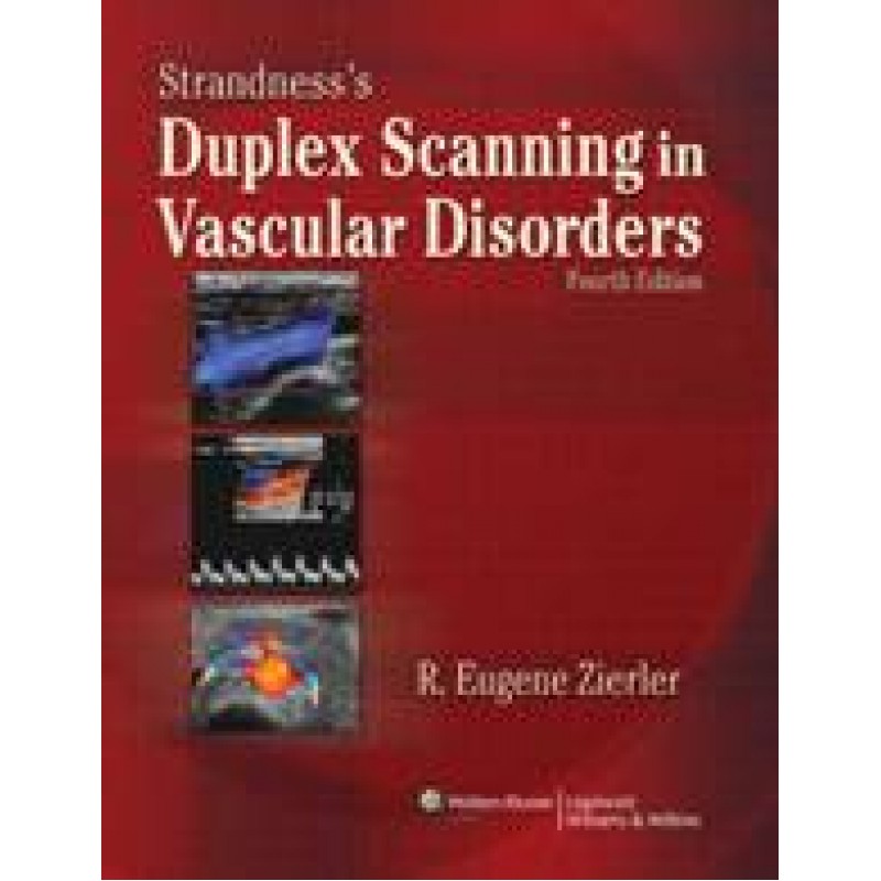 Strandness's Duplex Scanning in Vascular Disorders 4/e