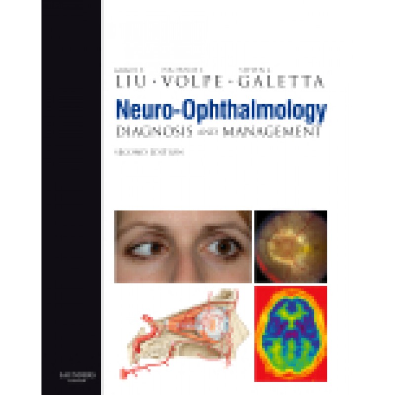 Neuro-Ophthalmology, 2nd Edition Diagnosis and Management, Book with DVD-ROM