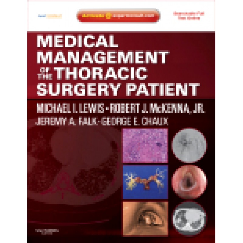 Medical Management of the Thoracic Surgery Patient Expert Consult - Online and Print