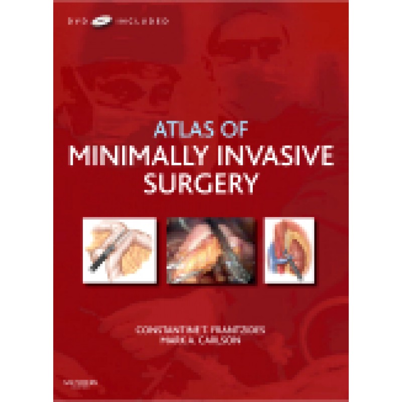 Atlas of Minimally Invasive Surgery with DVD