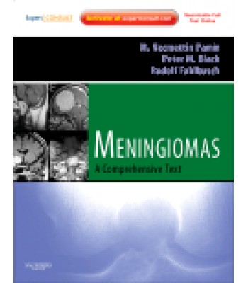 Meningiomas Expert Consult - Online and Print