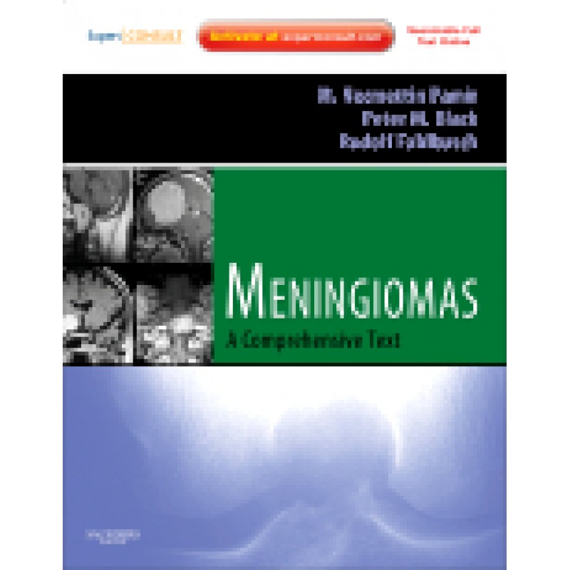 Meningiomas Expert Consult - Online and Print