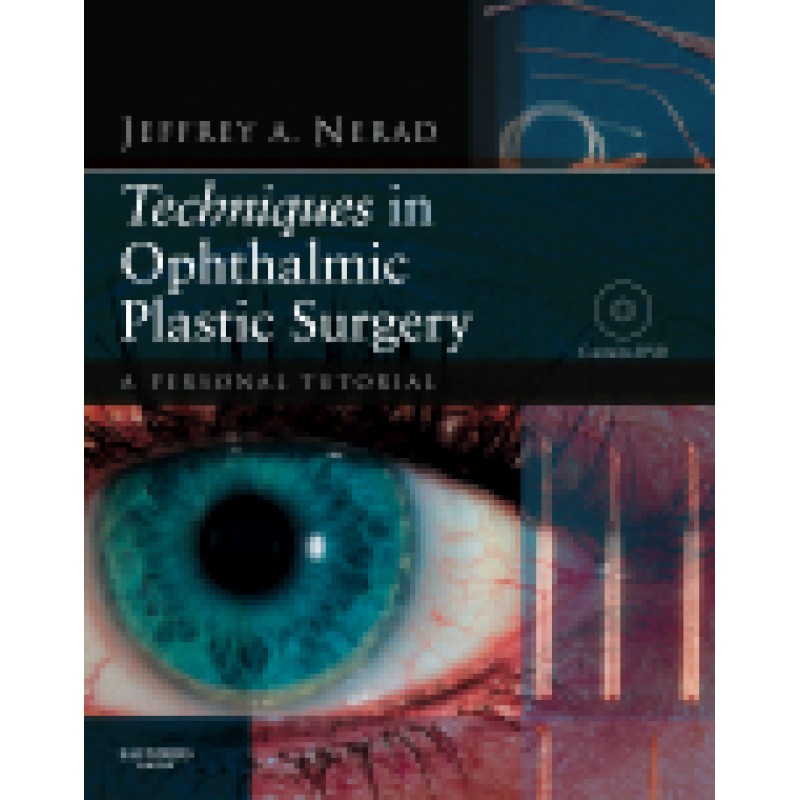 Techniques in Ophthalmic Plastic Surgery with DVD A Personal Tutorial