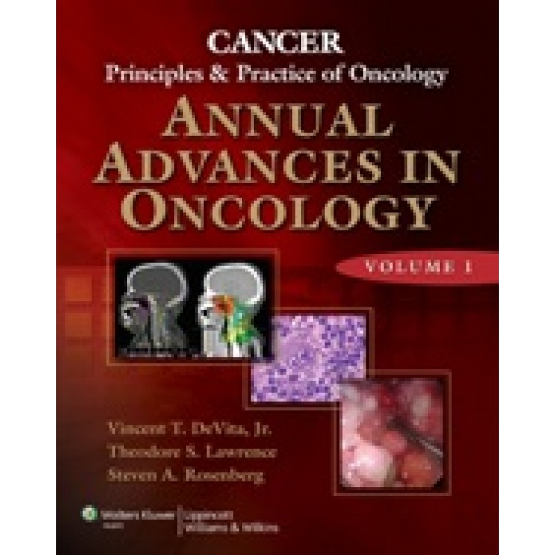 Cancer: Principles  and Practice of Oncology—Advances in Oncology - Volume 1 (Important Advances in Oncology )