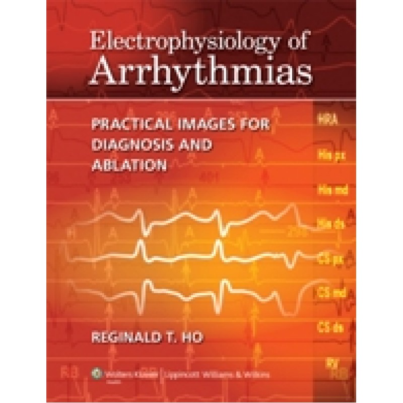 Electrophysiology of Arrhythmias (Practical Images for Diagnosis and Ablation)