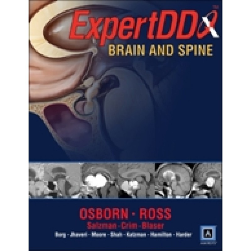 Expert Differential Diagnoses: Brain and Spine (Published by Amirsys®)