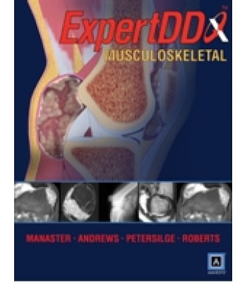 Expert Differential Diagnoses: Musculoskeletal (Published by Amirsys® )