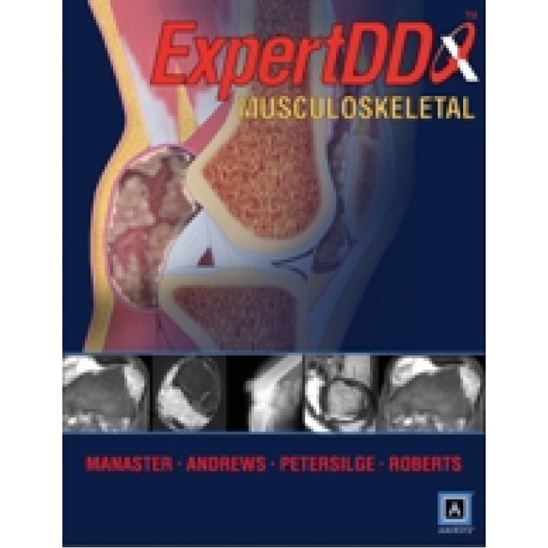 Expert Differential Diagnoses: Musculoskeletal (Published by Amirsys® )