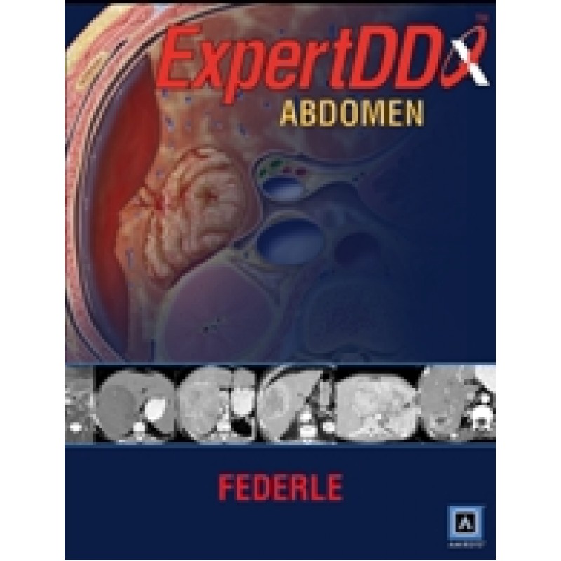 Expert Differential Diagnoses: Abdomen (Published by Amirsys®)