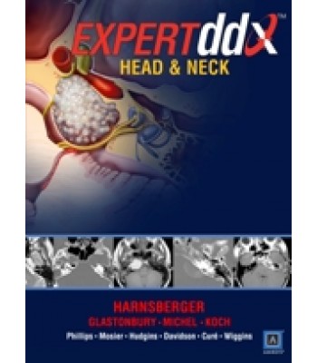 EXPERT Differential Diagnosis: Head and Neck