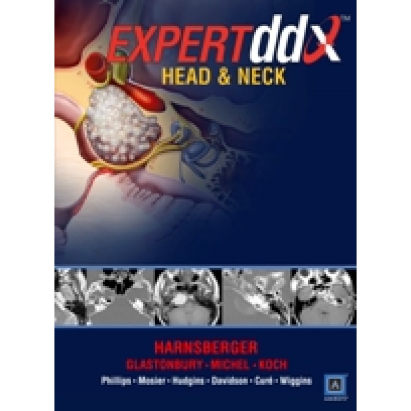 EXPERT Differential Diagnosis: Head and Neck