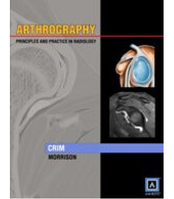Arthrography: Principles and  Practice in Radiology (Published by Amirsys® )