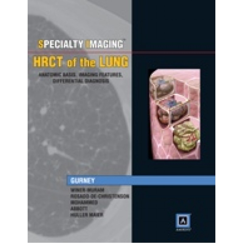 Specialty Imaging: HRCT of the Lung (Anatomic Basis, Imaging Features, Differential Diagnosis)