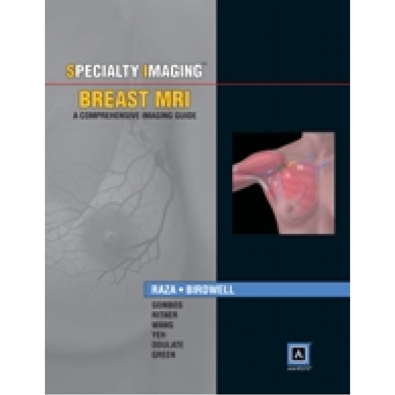Specialty Imaging: Breast MRI (A Reference Atlas)