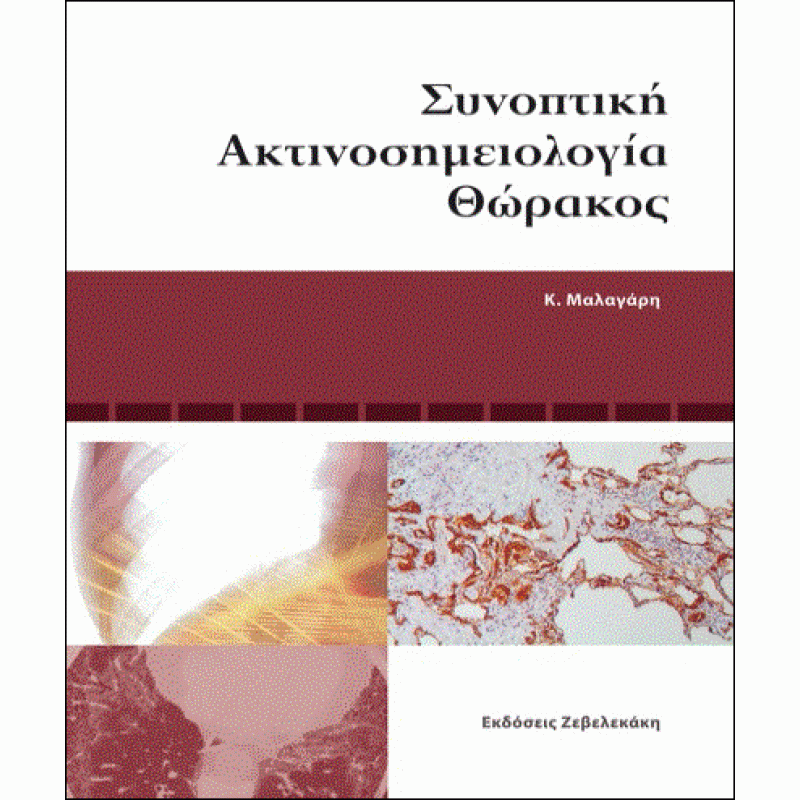 Συνοπτική Ακτινοσημειολογία Θώρακος. Μαλαγάρη
