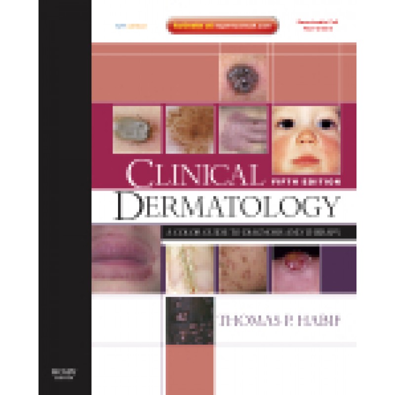 Clinical Dermatology, 5th Edition Expert Consult - Online and Print