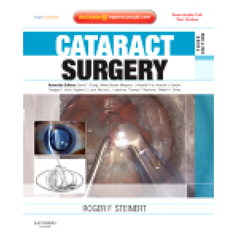 Cataract Surgery, 3rd Edition  Expert Consult - Online, Print and DVD