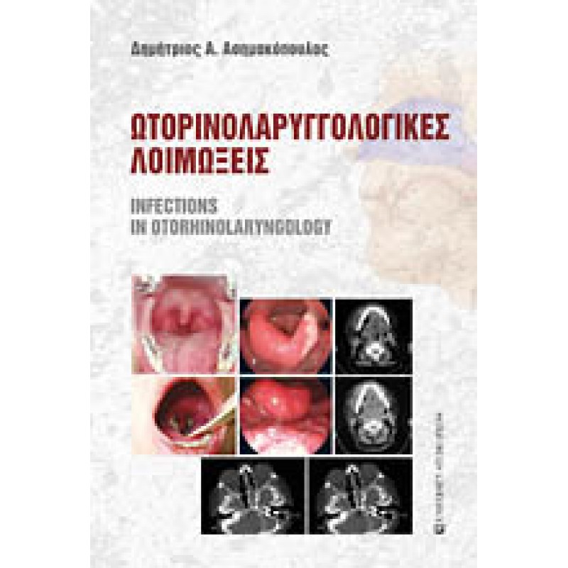ΩΤΟΡΙΝΟΛΑΡΥΓΓΟΛΟΓΙΚΕΣ ΛΟΙΜΩΞΕΙΣ Infections in Otorhinolaryngology