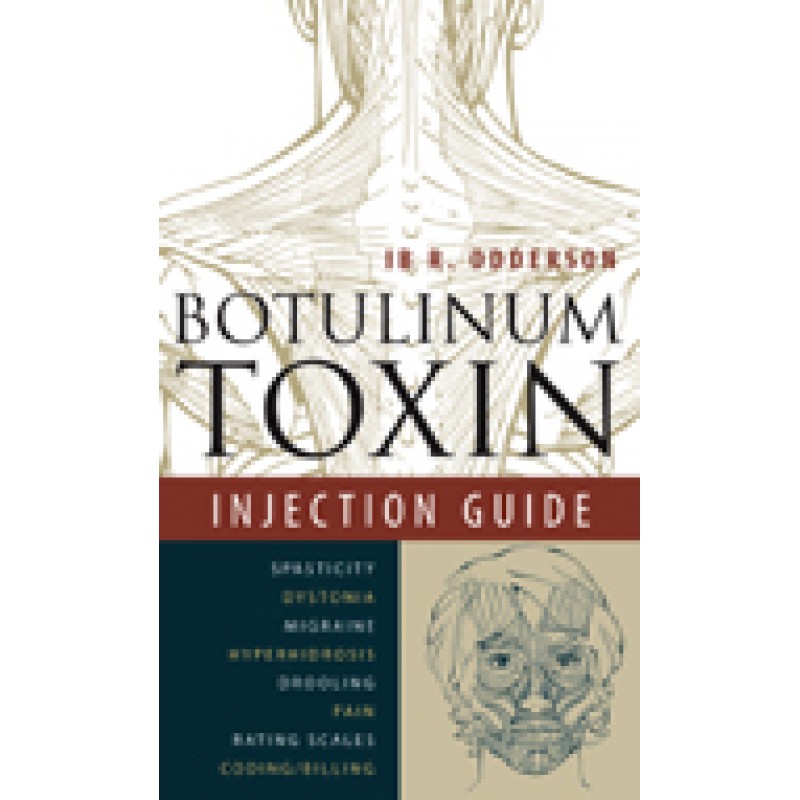 Botulinum Toxin Injection Guide