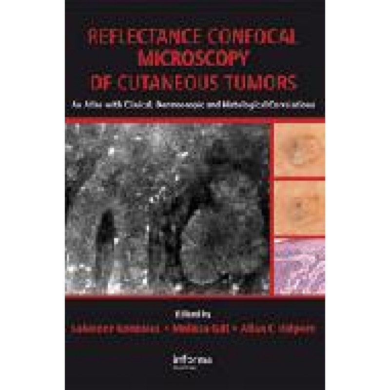 Reflectance Confocal Microscopy of Cutaneous Tumors: An Atlas with Clinical, Dermoscopic and Histological Correlations