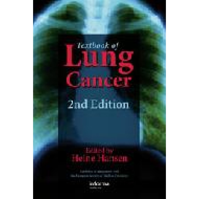 Textbook of Lung Cancer, Second Edition