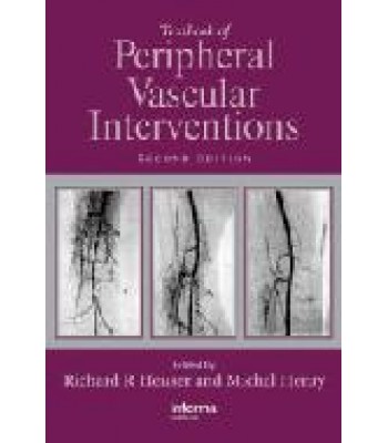 Textbook of Peripheral Vascular Interventions, Second Edition