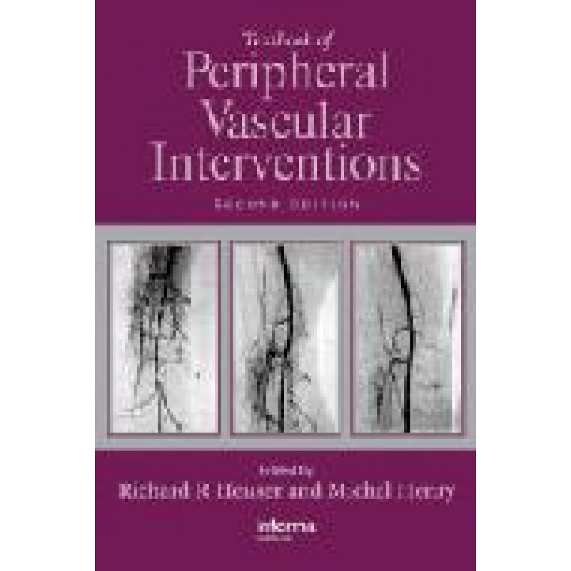 Textbook of Peripheral Vascular Interventions, Second Edition