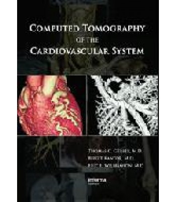 Computed Tomography of the Cardiovascular System