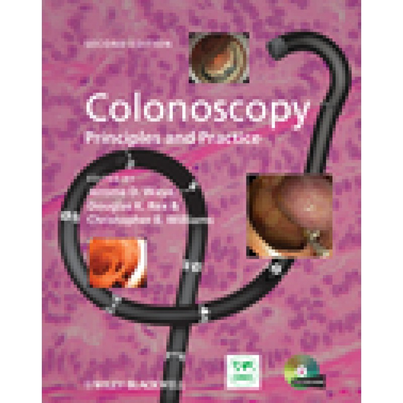 Colonoscopy: Principles and Practice, 2nd Edition