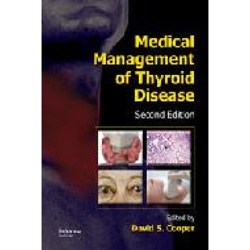Medical Management of Thyroid Disease, Second Edition