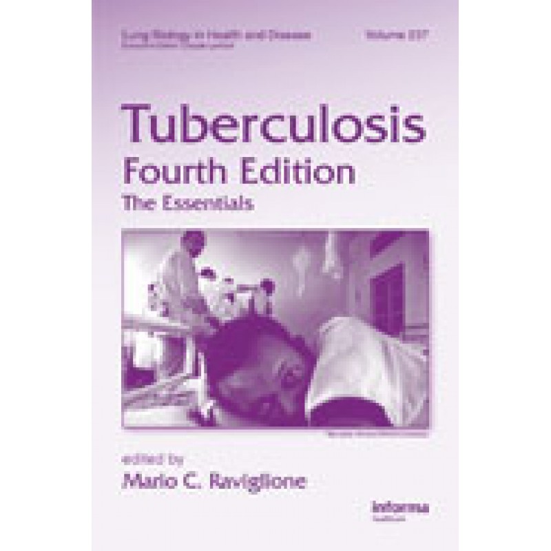 Tuberculosis: Τhe Essentials , 4th Edition