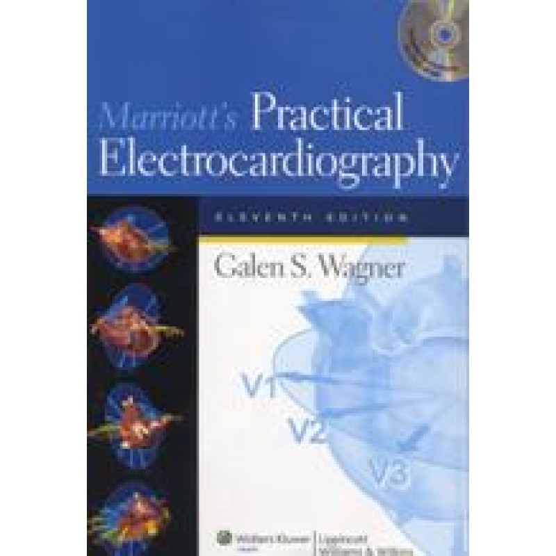 Marriott's Practical Electrocardiography 11/e