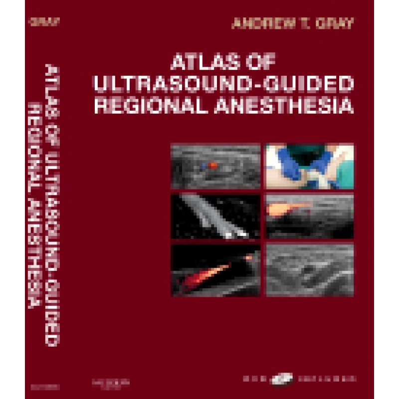 Atlas of Ultrasound-Guided Regional Anesthesia Expert Consult - Enhanced Online and Print