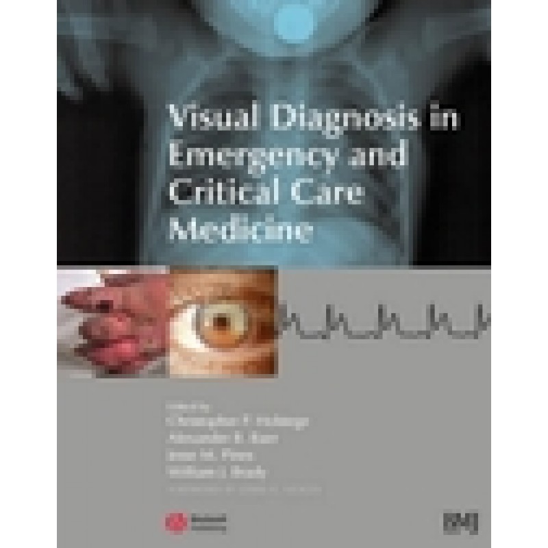 Visual Diagnosis in Emergency and Critical Care Medicine