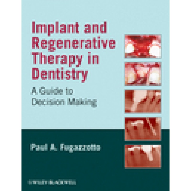 Implant and Regenerative Therapy in Dentistry: A Guide to Decision Making