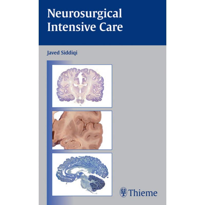 Neurosurgical Intensive Care