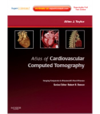 Atlas of Cardiovascular Computed Tomography: Expert Consult - Online and Print