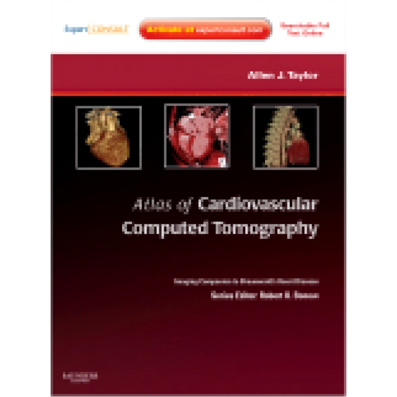Atlas of Cardiovascular Computed Tomography: Expert Consult - Online and Print