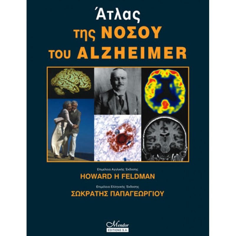 Άτλας της Νόσου Alzheimer