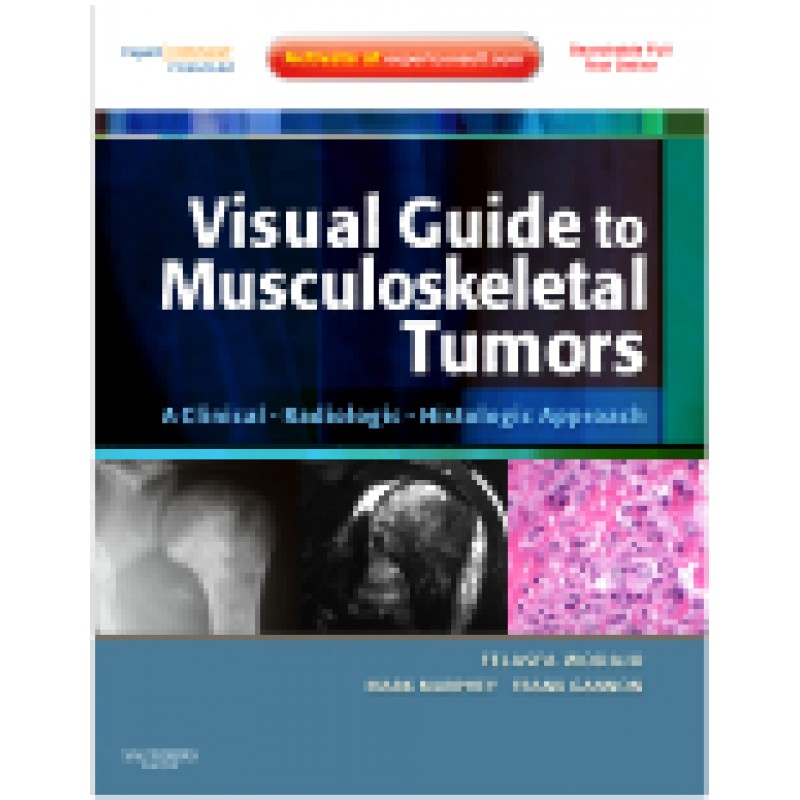 Visual Guide to Musculoskeletal Tumors: A Clinical - Radiologic - Histologic Approach